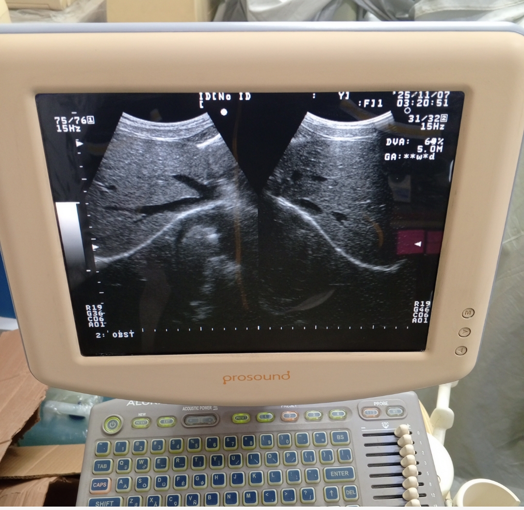 Ultrasound machine for sale, Contact; 0302-5698121